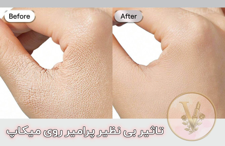 پرایمر کمراآن شیگلم اورجینال در ویونا