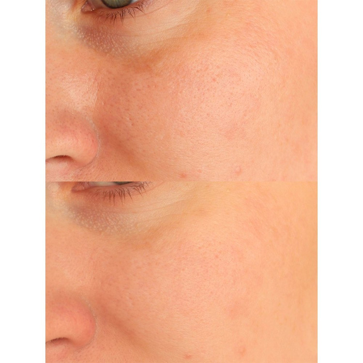 شوینده صورت سنتلا Tone Brightening | خرید فوم شستشو مناسب پاکسازی روزانه | ویونا